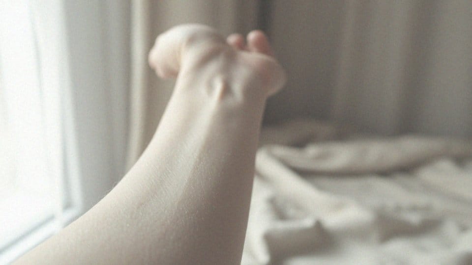 Jakie są najczęstsze objawy skórne u osób z PChN?